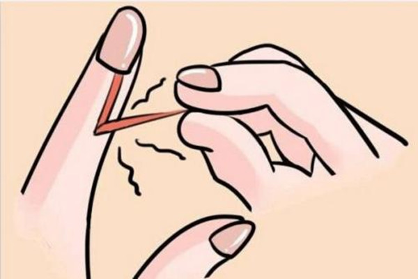 拔倒刺手腫了怎么辦 倒刺怎么處理不會(huì)腫