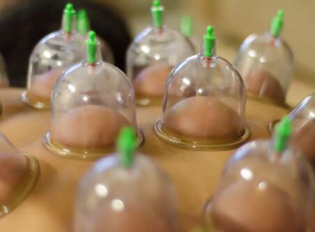 女人拔火罐的好處 冬天拔火罐減肥效果好嗎 女人拔火罐的好處 冬天拔火罐減肥效果好嗎