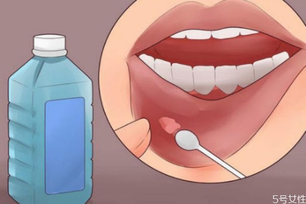 口腔潰瘍多長(zhǎng)時(shí)間自愈 口腔潰瘍吃什么水果 口腔潰瘍多長(zhǎng)時(shí)間自愈 口腔潰瘍吃什么水果