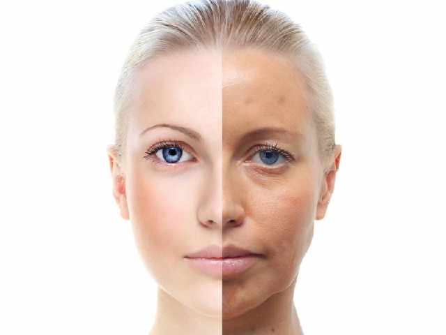 皮膚暗黃是什么原因 皮膚暗黃休息可以改善嗎