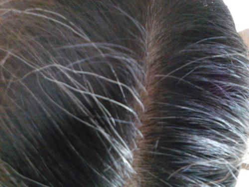 焦慮會(huì)長(zhǎng)白頭發(fā)嗎 白頭發(fā)如何預(yù)防