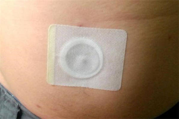 減肥肚臍貼哪個牌子好 減肥肚臍貼怎么用 減肥肚臍貼哪個牌子好 減肥肚臍貼怎么用