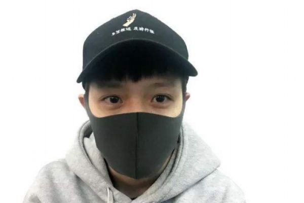 長時間戴口罩對皮膚的影響 戴口罩應該怎么護膚 長時間戴口罩對皮膚的影響 戴口罩應該怎么護膚