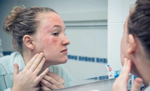 敏感肌用化妝品怎么樣做過(guò)敏試驗(yàn) 如何減少化妝對(duì)皮膚的傷害