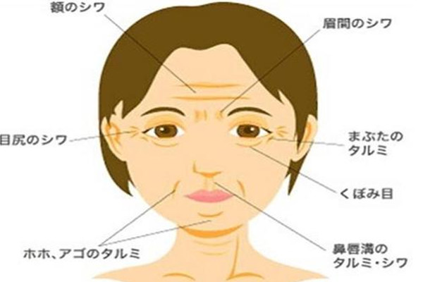 笑紋和魚尾紋的區(qū)別 笑紋只有笑的時(shí)候才有嗎 笑紋和魚尾紋的區(qū)別 笑紋只有笑的時(shí)候才有嗎