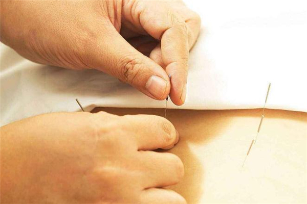 針灸減肥一個(gè)療程多少錢 針灸減肥一個(gè)療程是幾天 針灸減肥一個(gè)療程多少錢 針灸減肥一個(gè)療程是幾天