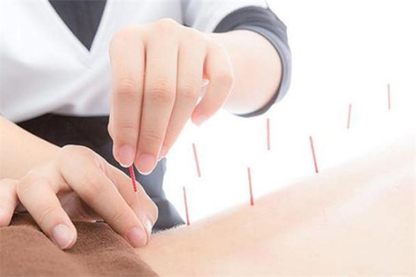 針灸減肥適合什么人 哪些人不適合針灸減肥 針灸減肥適合什么人 哪些人不適合針灸減肥