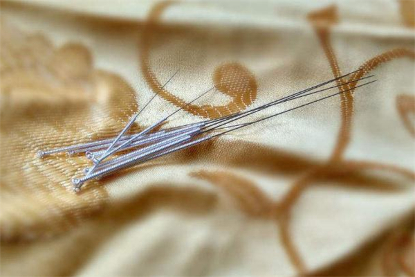 針灸減肥適合什么人 哪些人不適合針灸減肥 針灸減肥適合什么人 哪些人不適合針灸減肥