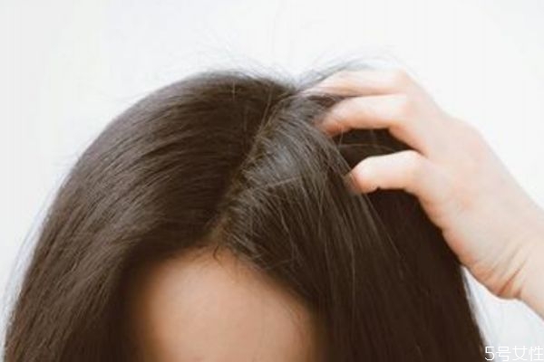 使用蓬蓬粉有什么害處 蓬蓬粉會導(dǎo)致掉頭發(fā)嗎 使用蓬蓬粉有什么害處 蓬蓬粉會導(dǎo)致掉頭發(fā)嗎