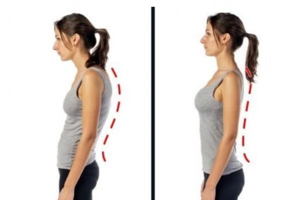 圓肩駝背形成的原因有什么 為什么會(huì)圓肩駝背 圓肩駝背形成的原因有什么 為什么會(huì)圓肩駝背