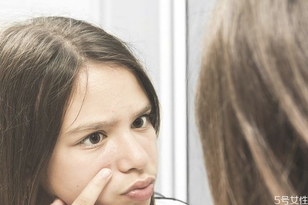 痘痘的治療方法 痘痘的調(diào)理方式 痘痘的治療方法 痘痘的調(diào)理方式