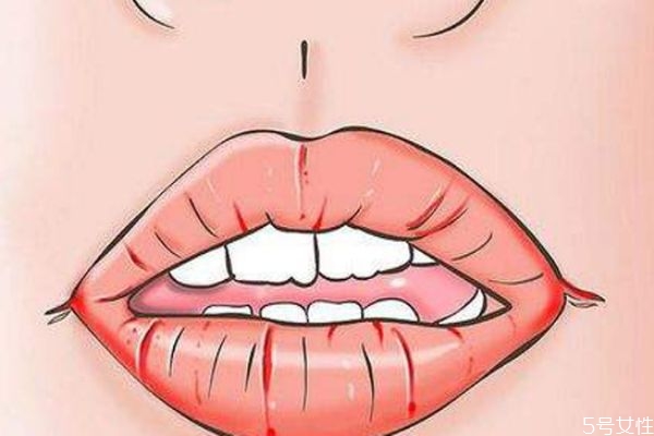 嘴唇很干燥為什么 怎么給嘴唇快速補水