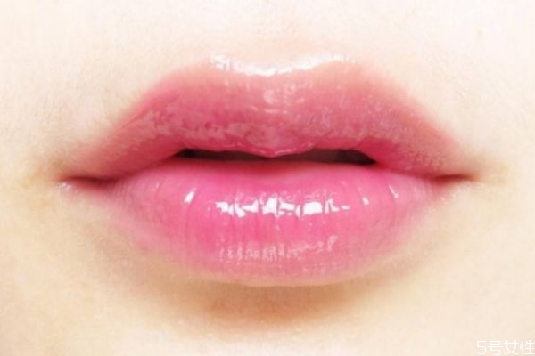 打完嘟嘟唇多久能自然 打完嘟嘟唇多久恢復(fù) 打完嘟嘟唇多久能自然 打完嘟嘟唇多久恢復(fù)