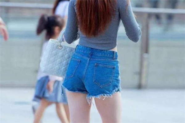 臀部肥胖紋可以消除嗎 臀部有肥胖紋怎么辦 臀部肥胖紋可以消除嗎 臀部有肥胖紋怎么辦