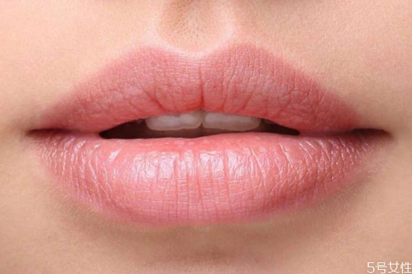 嘴唇發(fā)黑是怎么回事 嘴唇顏色為什么會變黑