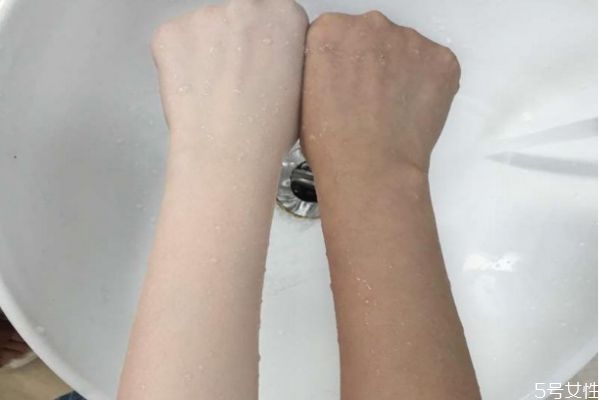 手肘膝蓋黑怎么變白 胳膊肘黑怎么變白 手肘膝蓋黑怎么變白 胳膊肘黑怎么變白