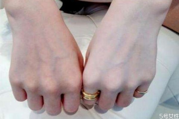 手肘膝蓋黑怎么變白 胳膊肘黑怎么變白 手肘膝蓋黑怎么變白 胳膊肘黑怎么變白