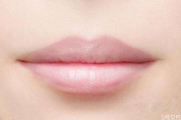 嘴唇發(fā)黑是怎么回事 嘴唇顏色為什么會變黑