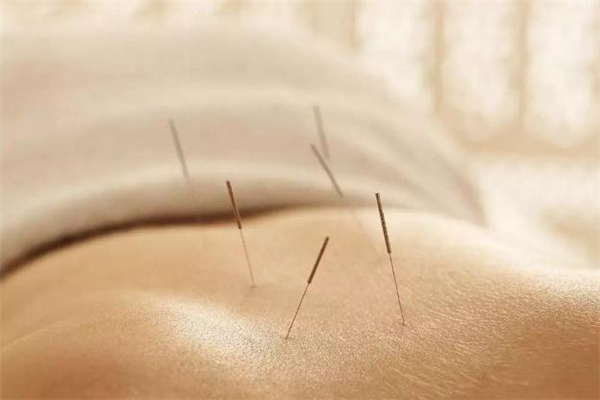 節(jié)食減肥的正確方法 節(jié)食減肥怎么避免反彈