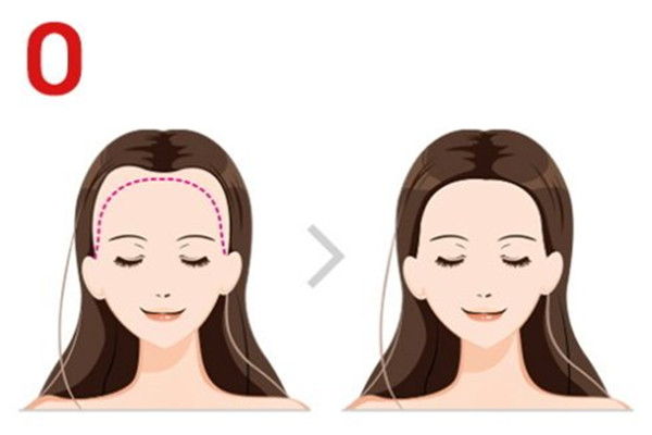 自體毛發(fā)種植的原理 自體毛發(fā)種植的特點