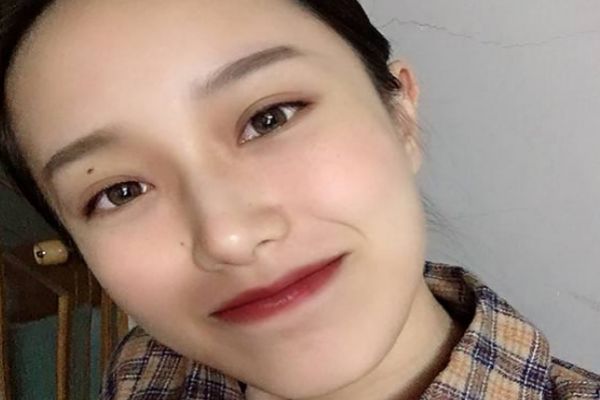 去鼻唇溝的方法 怎么去除鼻唇溝 去鼻唇溝的方法 怎么去除鼻唇溝