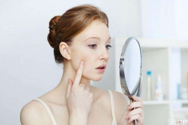 為什么化妝會(huì)長(zhǎng)痘 化妝長(zhǎng)痘的原因 為什么化妝會(huì)長(zhǎng)痘 化妝長(zhǎng)痘的原因