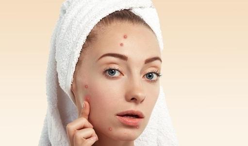 長痘痘后要注意什么 長痘痘后怎么辦 長痘痘后要注意什么 長痘痘后怎么辦