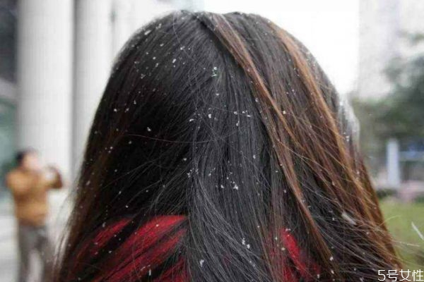 頭發(fā)容易出油怎么辦 頭發(fā)容易出油怎么解決 頭發(fā)容易出油怎么辦 頭發(fā)容易出油怎么解決