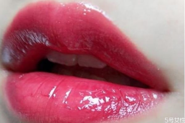 嘴唇上長(zhǎng)泡爛了怎么辦 嘴唇上長(zhǎng)泡可以涂紅霉素軟膏嗎