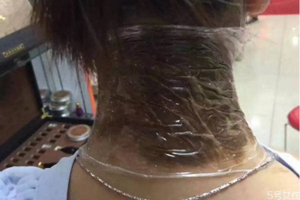 富貴包有什么危害 富貴包對(duì)身體的傷害 富貴包有什么危害 富貴包對(duì)身體的傷害