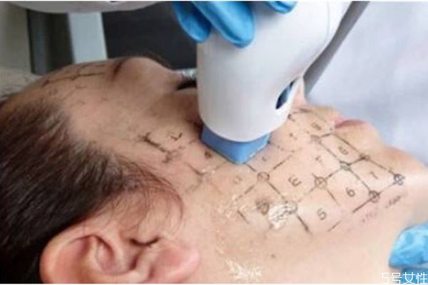 第五代熱瑪吉好嗎 5代熱瑪吉有什么優(yōu)勢 第五代熱瑪吉好嗎 5代熱瑪吉有什么優(yōu)勢