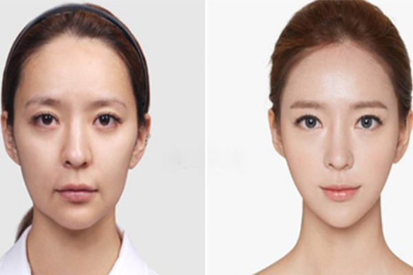 抗衰老針適合多大年齡 抗衰老針的成分 抗衰老針適合多大年齡 抗衰老針的成分