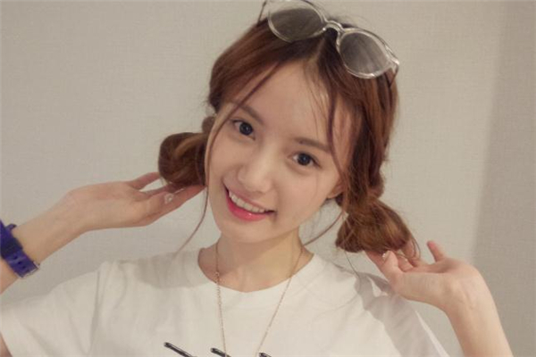 射頻去黑眼圈會紅腫嗎 射頻去黑眼圈安全嗎 射頻去黑眼圈會紅腫嗎 射頻去黑眼圈安全嗎