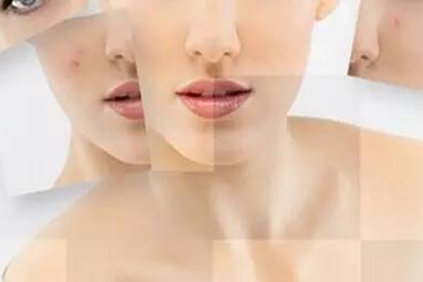 激光點痣后有紅印怎么辦？點痣后切記忌辛辣飲食