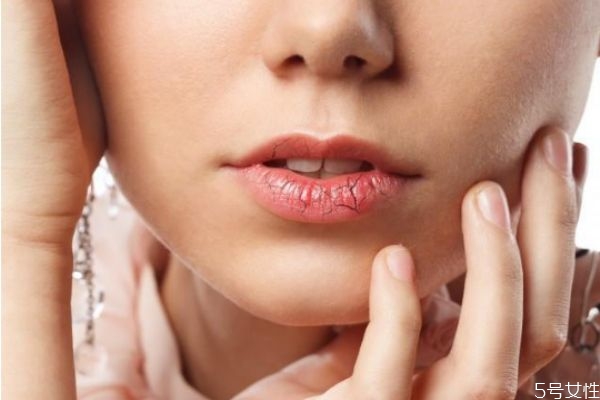 擦口紅導(dǎo)致嘴唇干裂脫皮怎么辦 唇部保養(yǎng)的方法 擦口紅導(dǎo)致嘴唇干裂脫皮怎么辦 唇部保養(yǎng)的方法