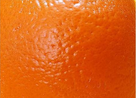 臉上毛孔粗大像雞皮一樣怎么辦 臉上毛孔粗大像雞皮一樣怎么辦