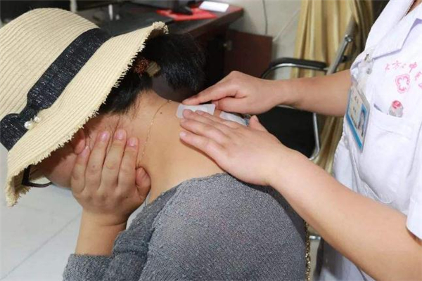 三伏貼一次貼幾張 貼三伏貼要忌口多長時間 三伏貼一次貼幾張 貼三伏貼要忌口多長時間