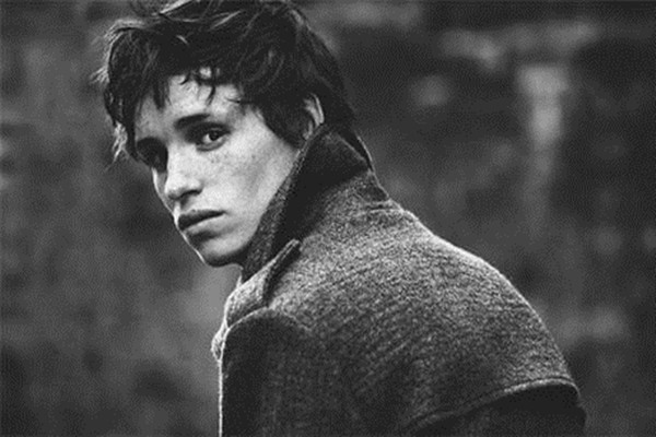 男生為什么會長雀斑 男生長雀斑的原因 男生為什么會長雀斑 男生長雀斑的原因