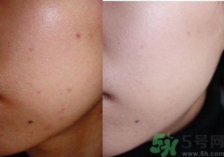 ipsa三色遮瑕膏好用嗎？茵芙莎三色遮瑕膏用法？