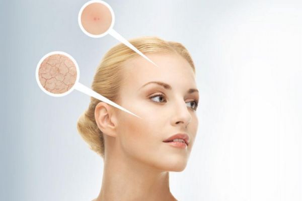 面部松弛下垂怎么辦 面部松弛下垂怎么解決 面部松弛下垂怎么辦 面部松弛下垂怎么解決