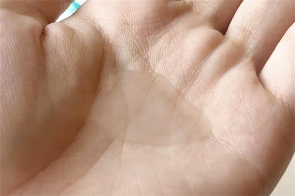 麗普司肽凍干粉可以祛痘印嗎 麗普司肽修護(hù)版和祛痘版區(qū)別 麗普司肽凍干粉可以祛痘印嗎 麗普司肽修護(hù)版和祛痘版區(qū)別