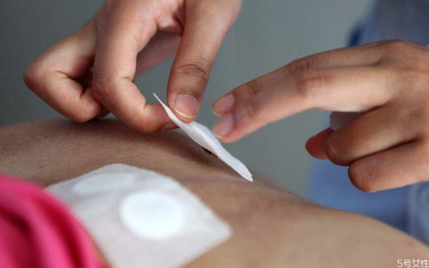 三伏貼為什么貼了感覺(jué)涼 三伏貼祛濕效果如何