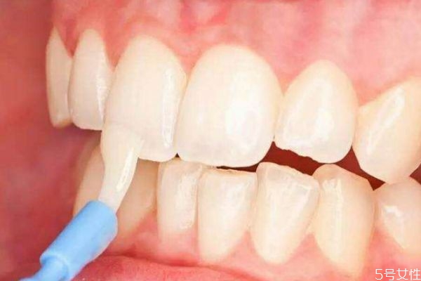 怎么刷牙讓牙齒變白 牙齒變白的小妙招 怎么刷牙讓牙齒變白 牙齒變白的小妙招