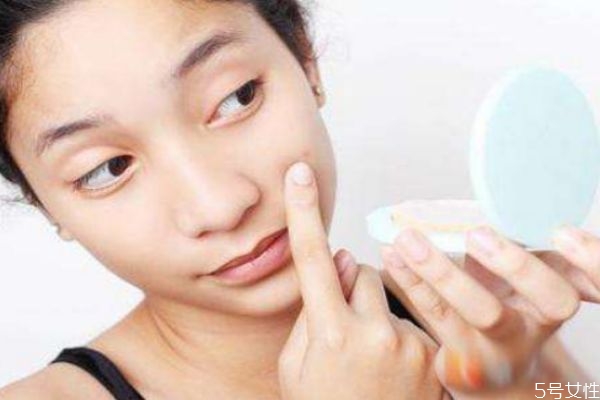 如何正確擠痘 你會(huì)正確的擠痘痘嗎