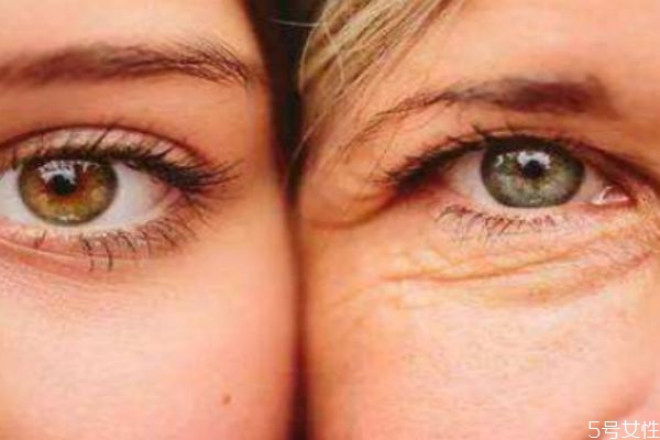 維生素e加凡士林可以去眼紋嗎 維生素e加凡士林要洗嗎 維生素e加凡士林可以去眼紋嗎 維生素e加凡士林要洗嗎