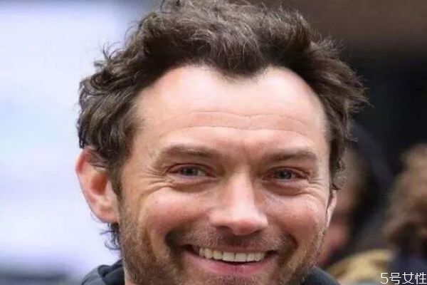 m字型發(fā)際線怎么辦 m型發(fā)際線一定會(huì)禿頂嗎