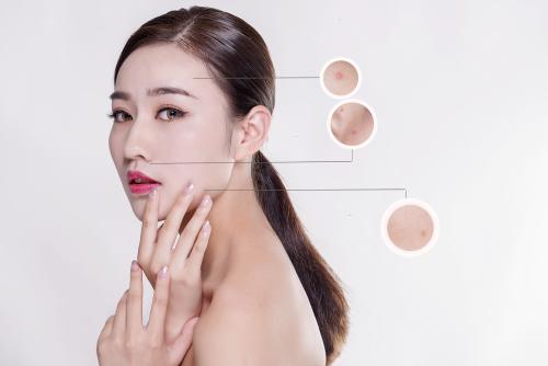 臉部死皮多是怎么回事 臉部死皮怎么去 臉部死皮多是怎么回事 臉部死皮怎么去