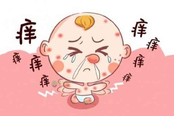 孩子過敏要去醫(yī)院嗎 孩子過敏要吃什么藥