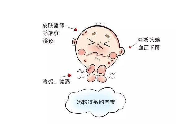 過(guò)敏的癥狀是什么樣子的 過(guò)敏的原因有哪些
