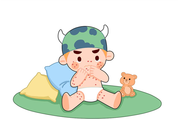 長痱子有什么癥狀 長痱子能根治嗎